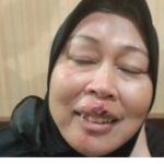 Korban Penganiayaan Debt Collector di Bulukumba Masih Trauma, Minta Pelaku Ditangkap