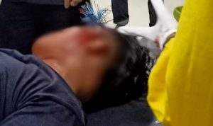 Pemuda Ela-ela Jadi Korban Pembusuran Pengendara Misterius 