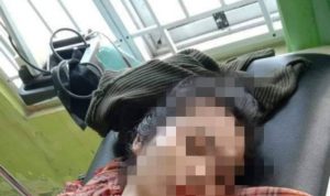 Begal Mengganas di Bulukumba, Seorang Mahasiswi Luka-luka Usai Tas Miliknya Dirampas Pelaku