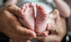 ilustrasi bayi achondroplasia 169