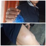 Warga Desa Bulo-Bulo Bulukumpa Jadi Korban Pembusuran Orang Tak Dikenal 