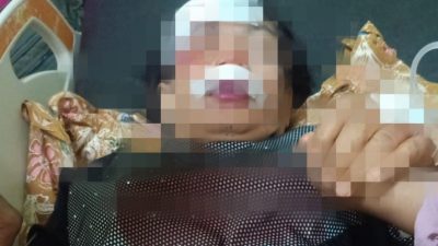 Pulang Pengajian, Dua Orang IRT di Bulukumba Jadi Korban Tabrak Lari