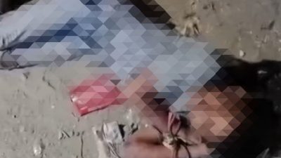 ilustrasi korban penganiayaan anak di Kajang yang mengalami luka parah