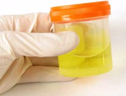 Seluruh Perangkat Desa di Indonesia Wajib Tes Urine!