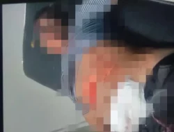 Pengendara Motor yang Ditemukan Penuh Luka di Selokan, Meninggal Dunia